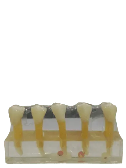 Study Model Molar Transparent 5pcs Strips