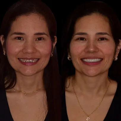 Beauty Dental | Puentes dentales en zirconio | diseño sonrisa