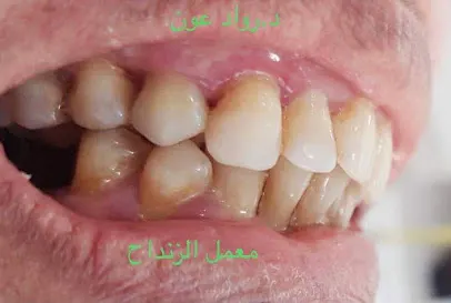 معمل الزنداح لصناعة الاسنان Zendah Dental Lab