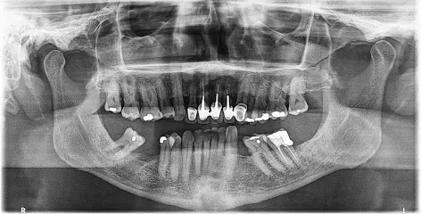 ORX CENTRO RADIOLOGICO SAS - Ayudas Diagnósticas Odontologicas Avanzadas