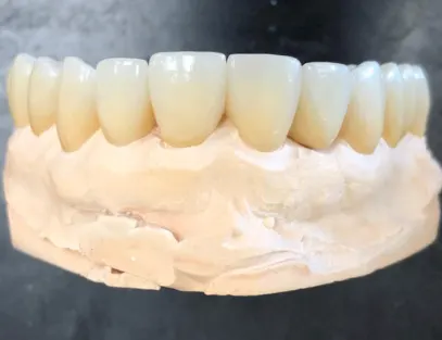Innovative Dental Laboratories