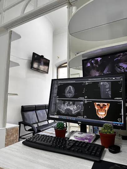 3D TOMAGRAFIYA RENTGEN