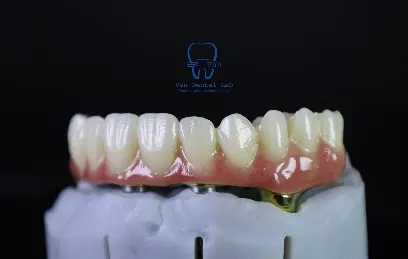 Van Dental Lab