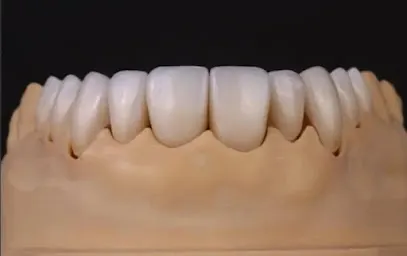 مختبرات دنيا للاسنان
