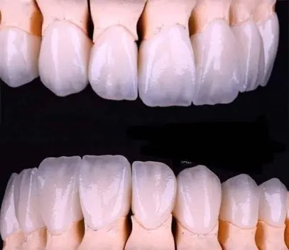 ZirconMe dental lab