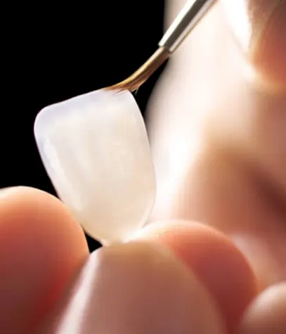 MicroDental Laboratory Vancouver