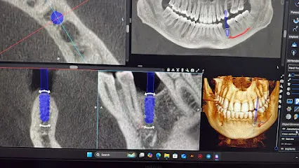 مركز روما لأشعة الاسنان