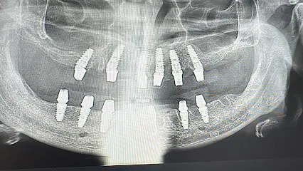 Illusion Dental Laboratory | Illusion Zirconia