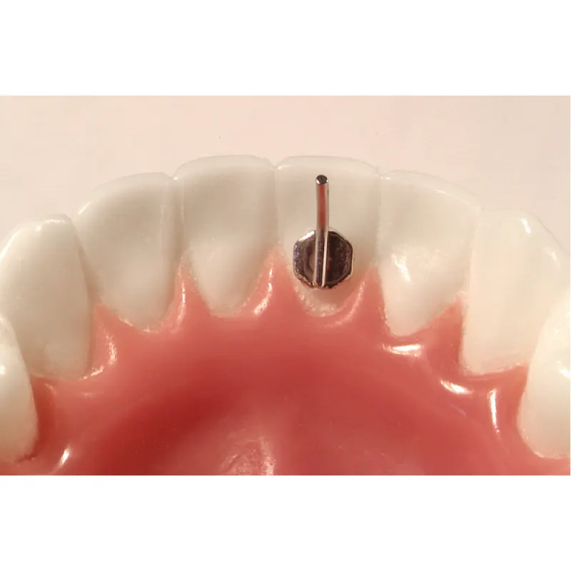 DB LINGUAL TONGUE DIRECTOR 7MM 10/PKG