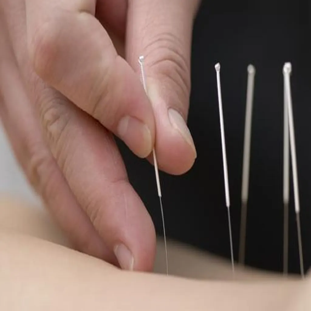 Accupuncture Needles | ابر وخز صينية