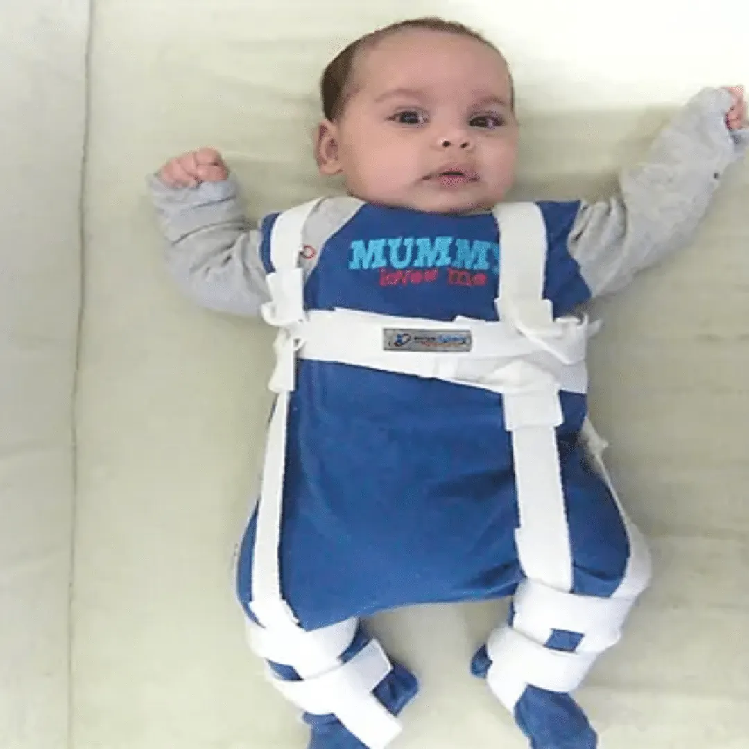 Pavlik Hip Orthosis | حزام تقويم الحوض للاطفال