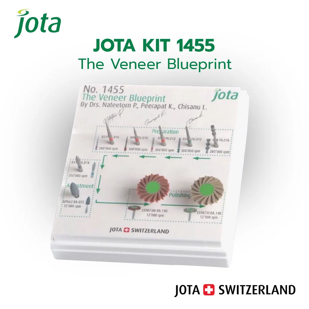 Jota Kit 1455 The Veneer Blueprint