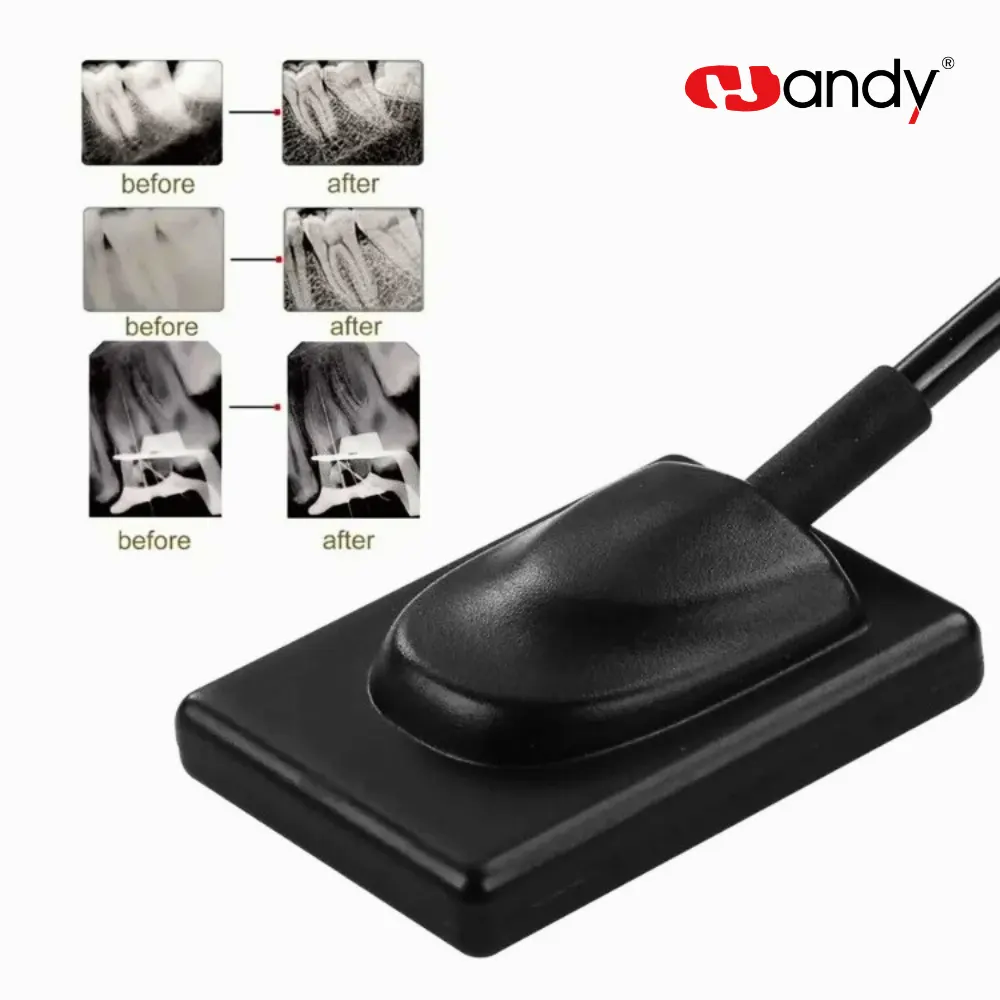 SENSOR RADIOGRÁFICO DENTAL HANDY