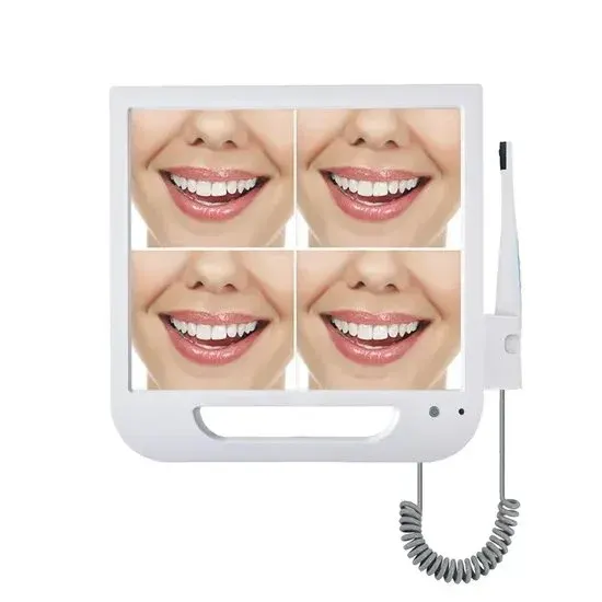 Digital Intraoral Camera
