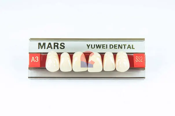 MARS Pontics SS2 A3