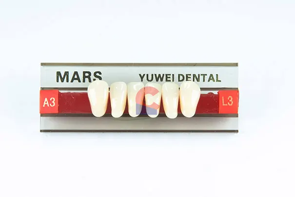 MARS Pontics L3 A3
