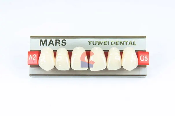 MARS Pontics O5 A2