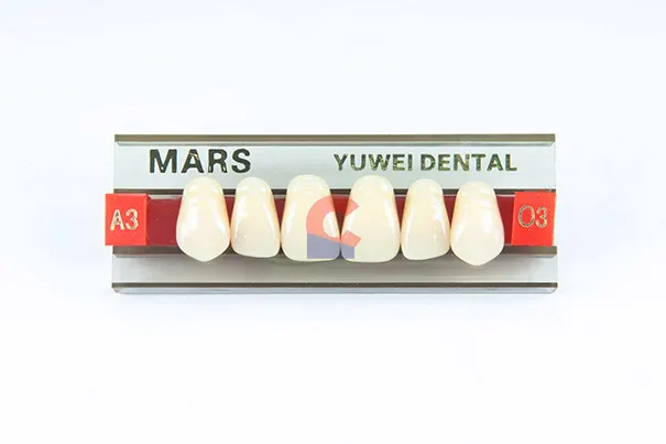 MARS Pontics O3 A3