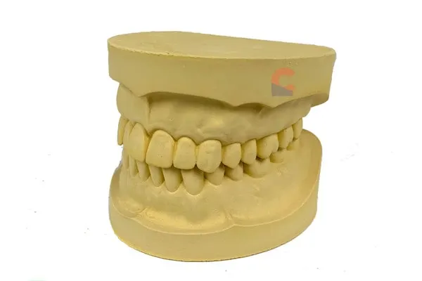 Dentulous Cast (Ideal Cast)