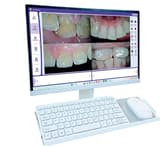 MIPONT intra Oral Camera 18 MegaPixel 19