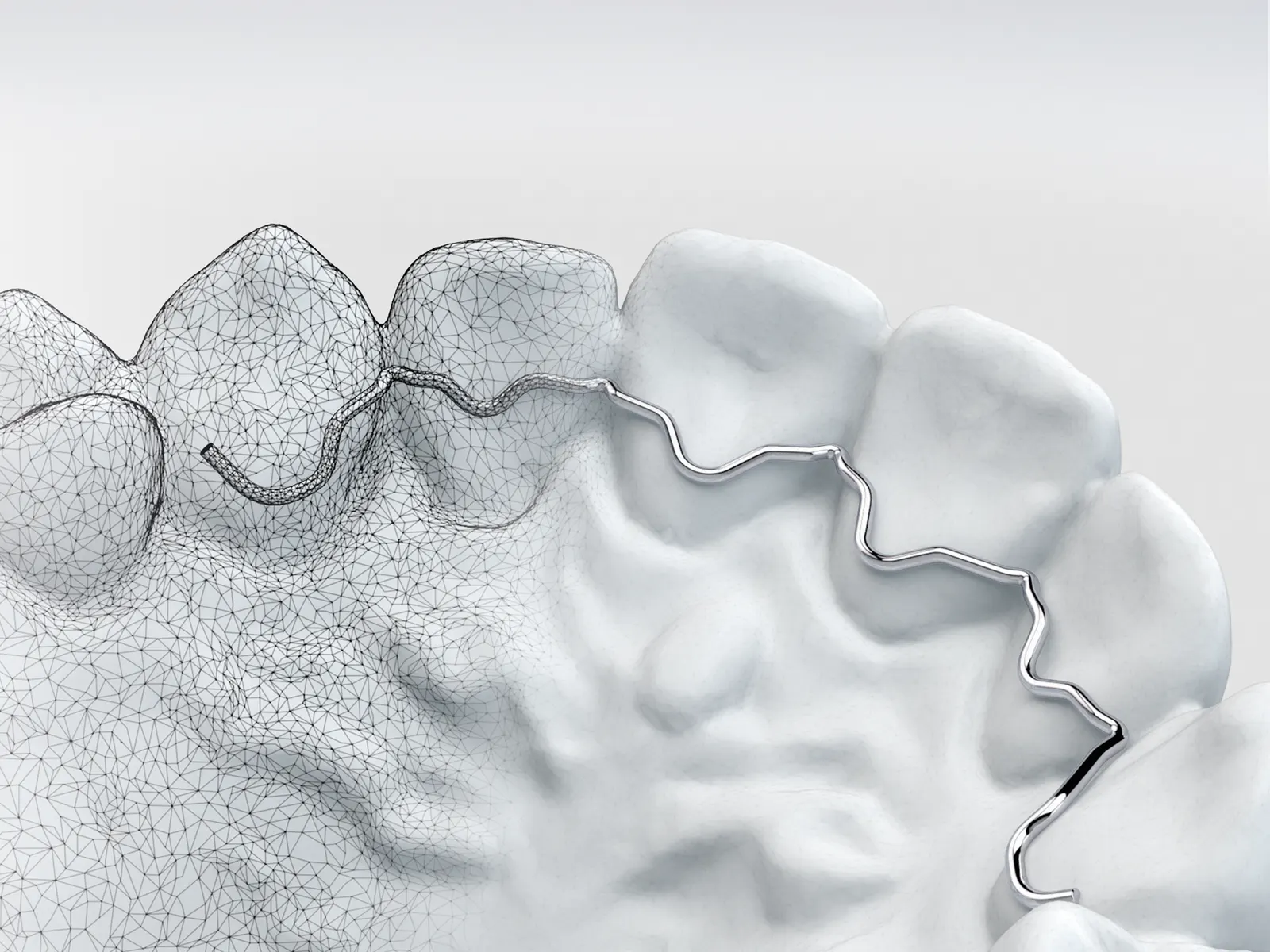 Digital orthodontics –