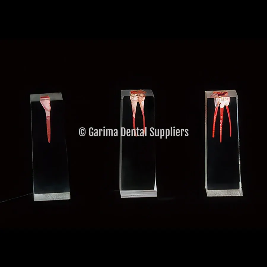 JM Filled Extended Root Canal