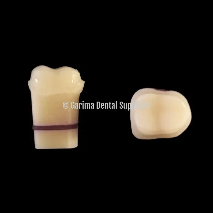 CLASS II Overlay Prepared+Prosthetic CAD/CAM #16