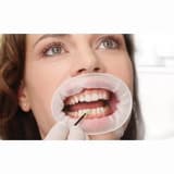 Ivoclar OptraGate Small size