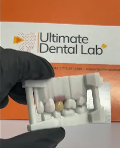 Ultimate Dental, Denture, Crown & Implants Lab