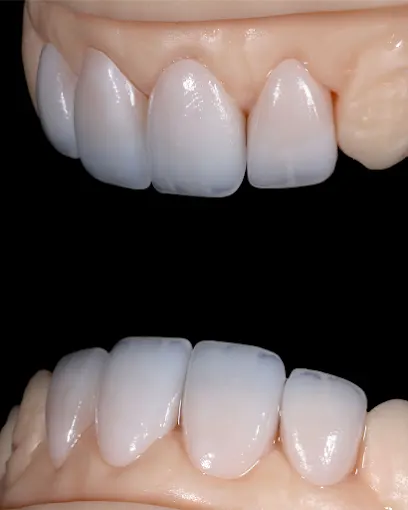 Bidental Laboratorio dental