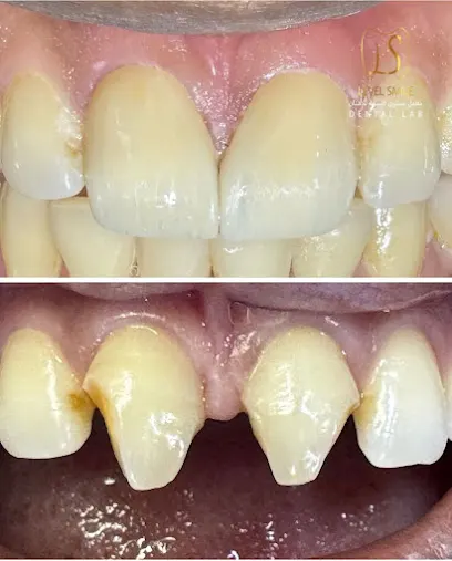 level smile dental lab معمل اسنان مستوى البسمة