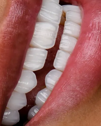 MICRO TECH DENTAL LAB