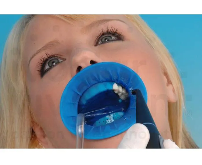 OptraDam