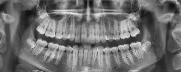 Radiografias panoramicas