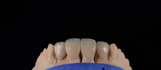 VENEERS DENATL LAB