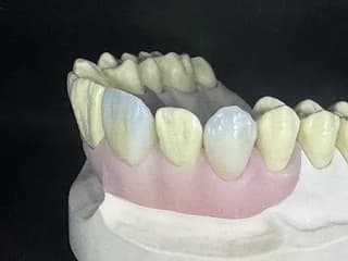 ALI STAEADA AL RAQMIA Dental Lab