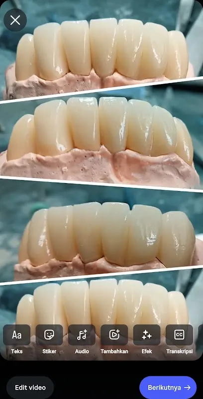 HDL Dental Art Lab