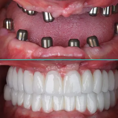 Via Dental Diş Protez Laboratuvarı