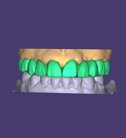 Zirconia Lab