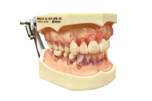Nissin Advance Periodontal Study Model Clear Pink Gums