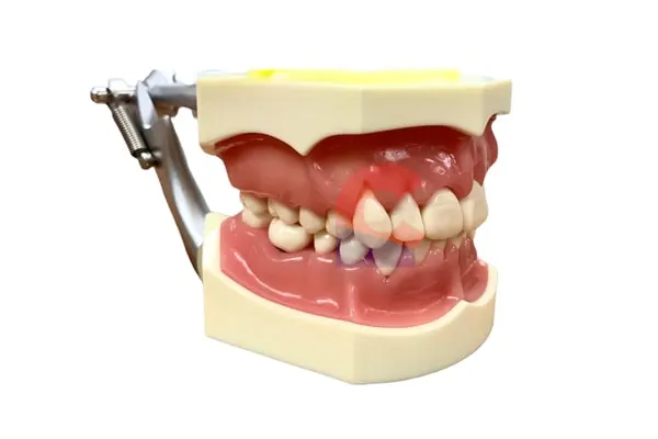 Nissin Advance Periodontal Study Model Nylon Fiber Gums