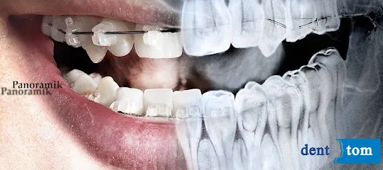 Denttom Dental Görüntüleme Merkezi (diş tomografisi - Panoramik Röntgen)