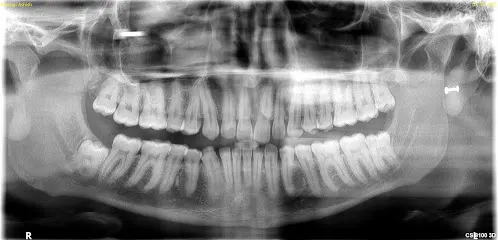 DENTAL IMAGING CENTRE