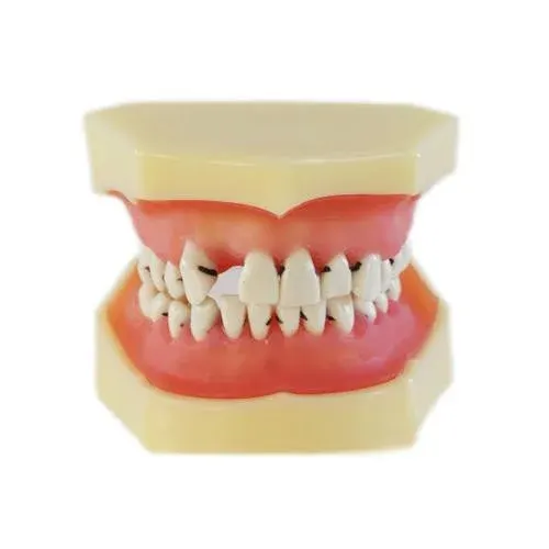 HST Periodontal Disease Study Model – L3