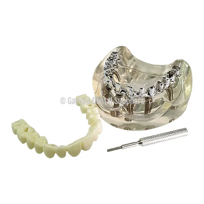 Unique Dental – Tooth Model Screw Implant
