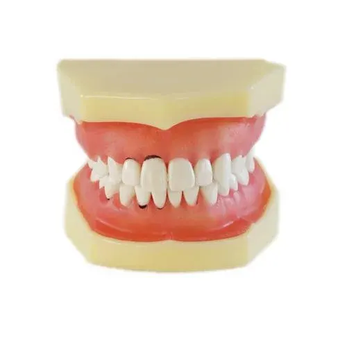 HST Periodontal Disease Study Model – L2