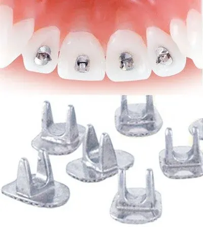 United Dental Tongue Tamers – pkt of 10pcs