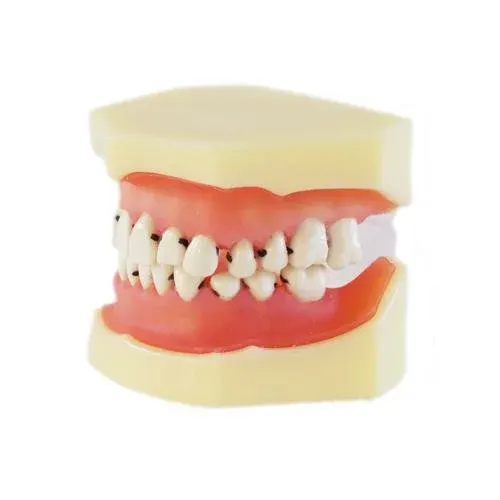HST Periodontal Disease Study Model – L4