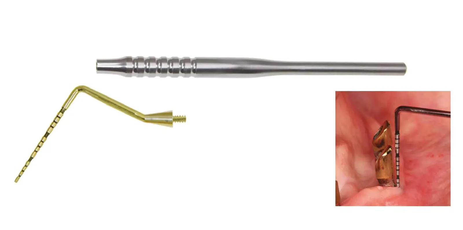 Embout sonde parodontale et implantaire : DENTAL PACIFIC