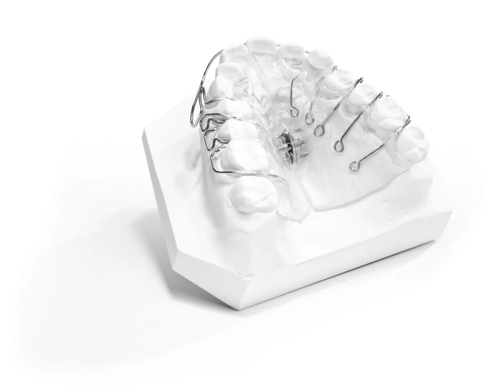 DENTONA Ortho Stone Plaster White 22kg